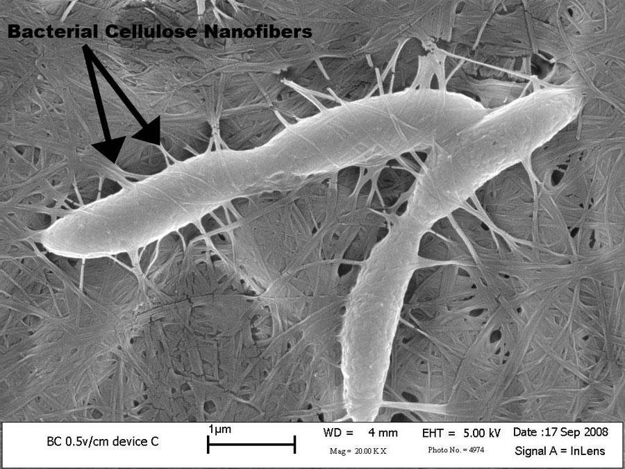 Exploring the Role of Acetobacter xylinum in Brewing Perfect Kombucha